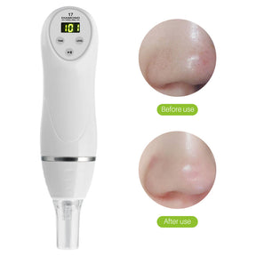 Electric pore suction and acne removing device beauty cleaner My Store