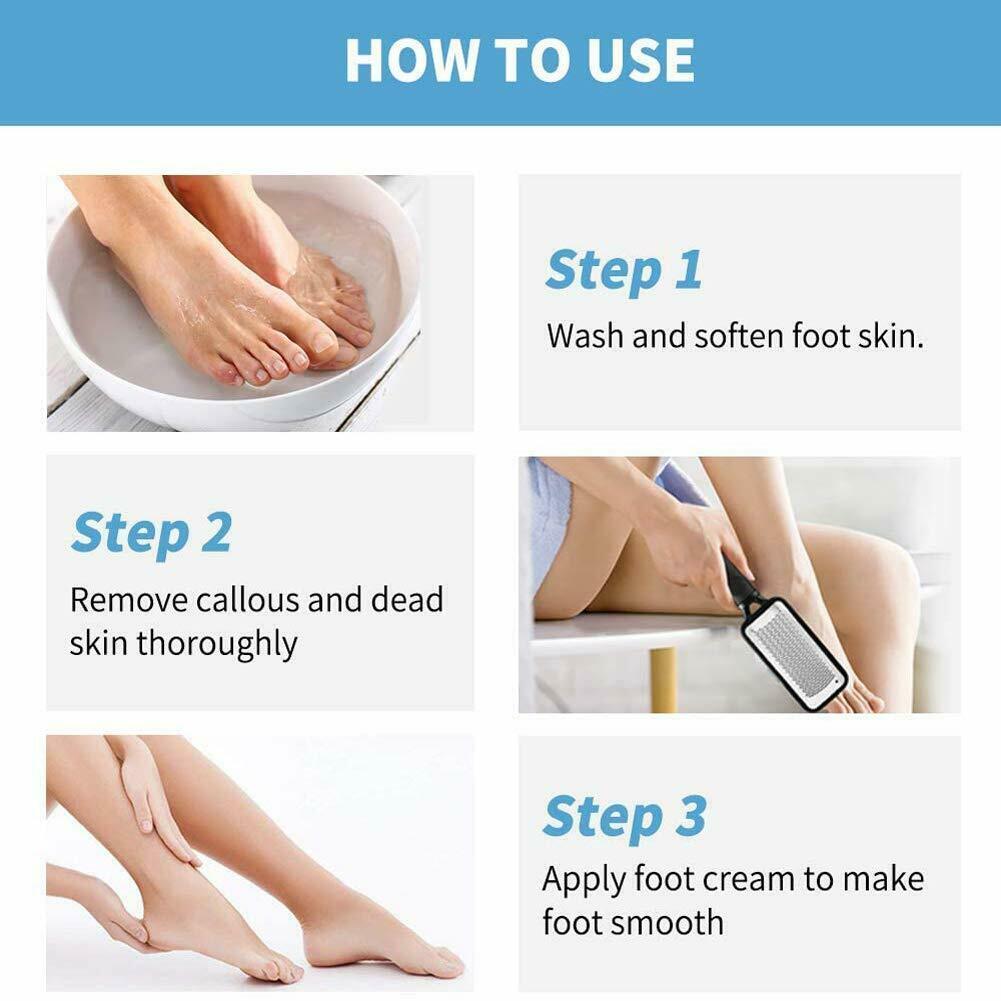 Professional Foot Callus Remover File Rasp Scraper Cracked Pedicure Rough Tool My Store