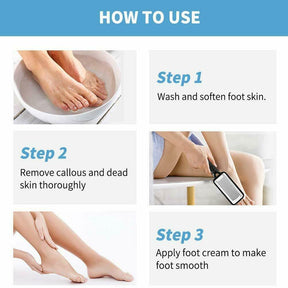 Professional Foot Callus Remover File Rasp Scraper Cracked Pedicure Rough Tool My Store