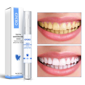 Teeth Whitening Pen Cleaning Serum Remove Plaque Stains Dental Tools Whiten Teeth Oral Hygiene Tooth Whitening Pen My Store