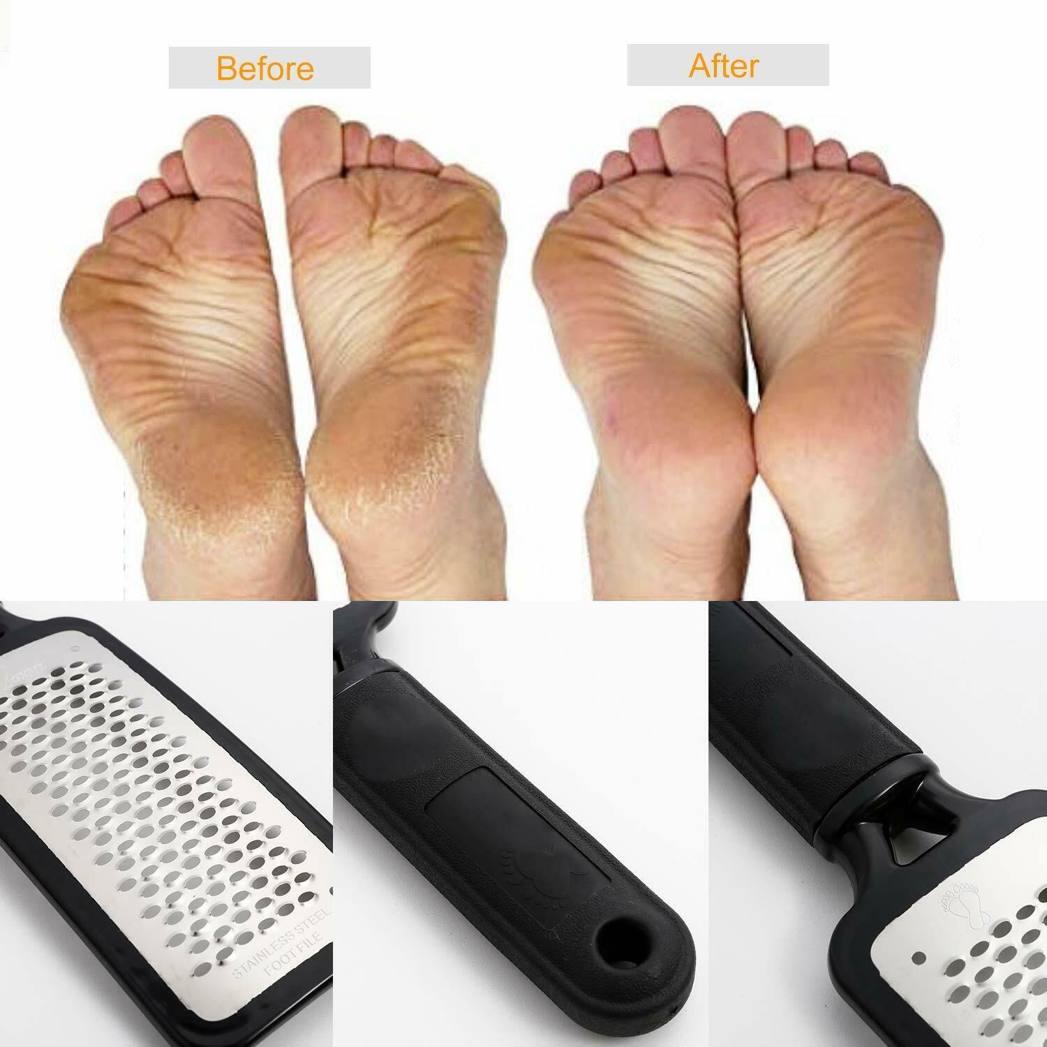 Professional Foot Callus Remover File Rasp Scraper Cracked Pedicure Rough Tool My Store