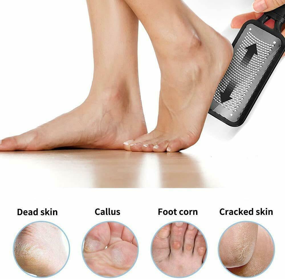 Professional Foot Callus Remover File Rasp Scraper Cracked Pedicure Rough Tool My Store