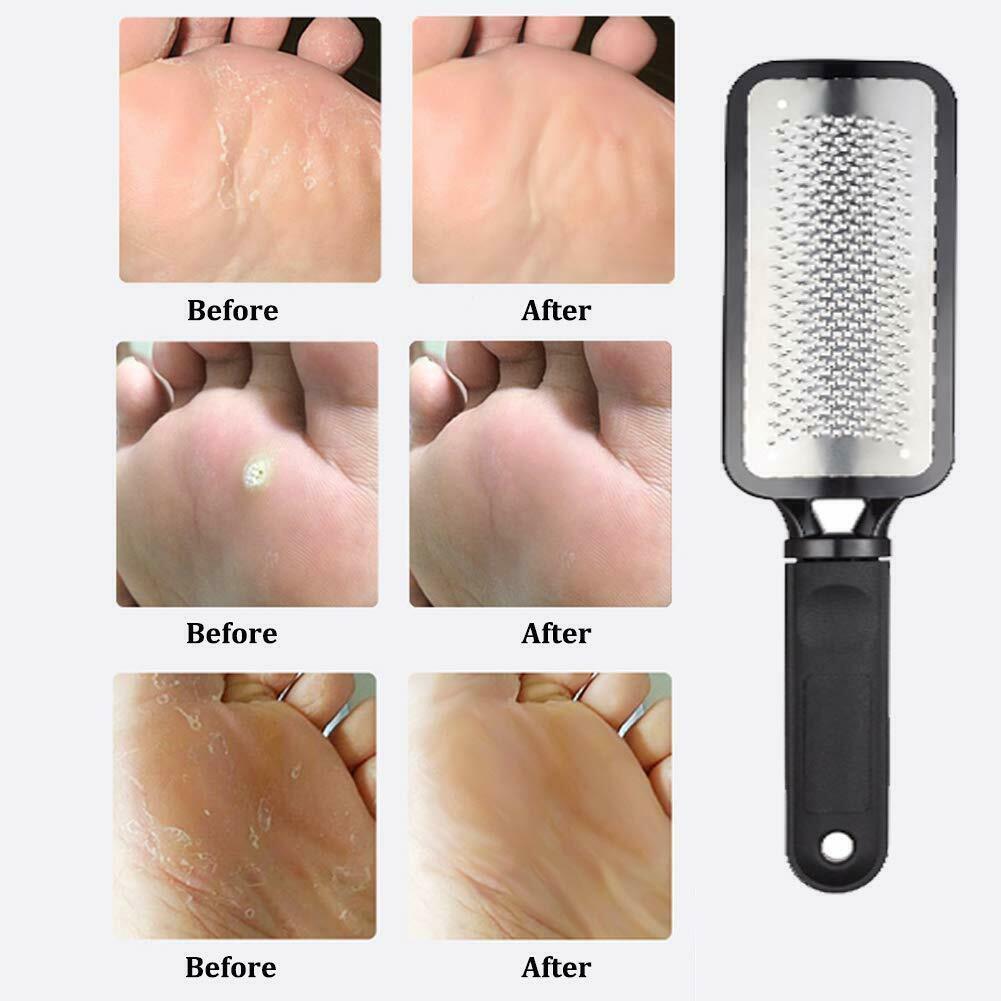 Professional Foot Callus Remover File Rasp Scraper Cracked Pedicure Rough Tool My Store