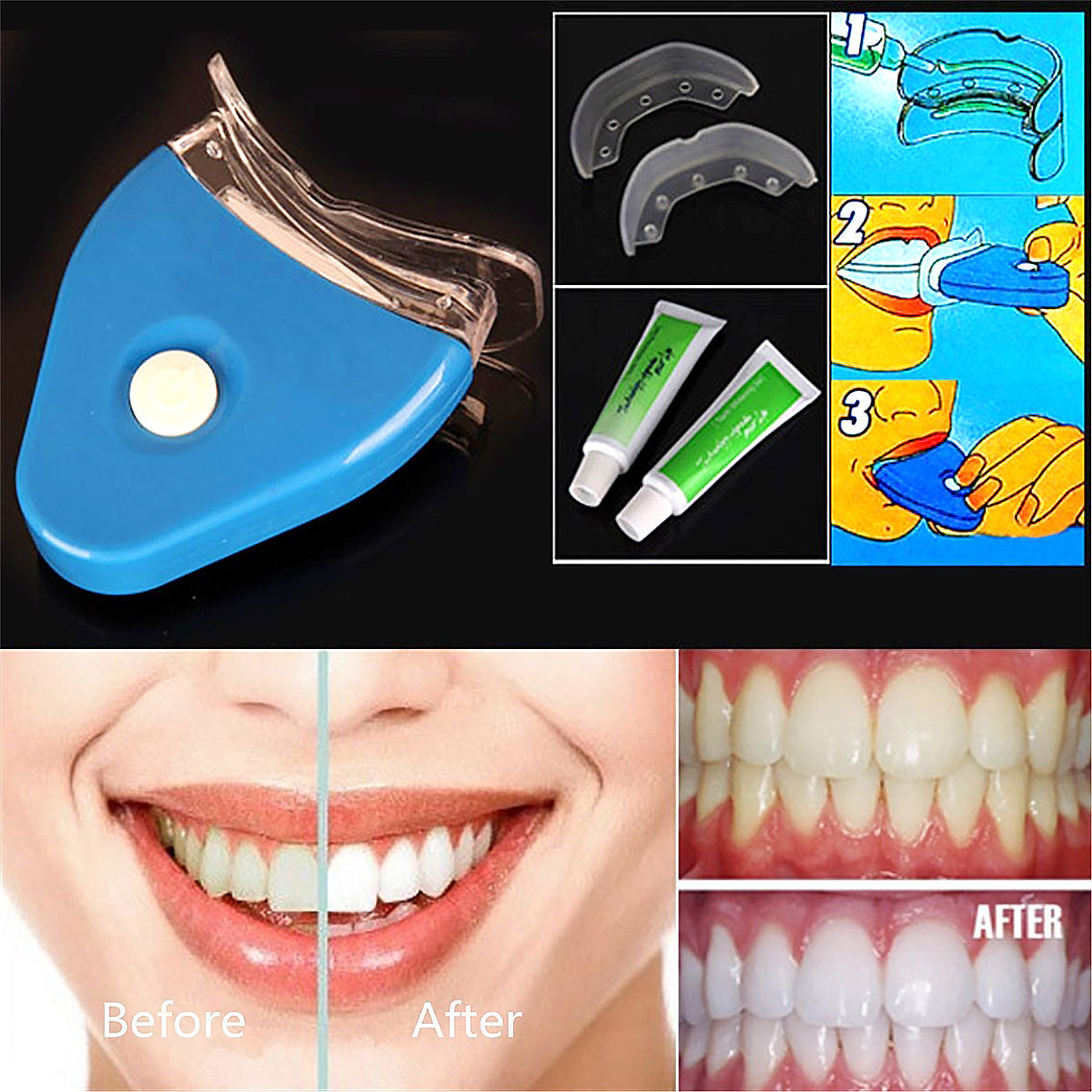 Oral Gel Teeth Tooth Whitening Whitener Dental Bleaching LED My Store